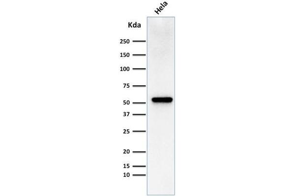 Fascin antibody