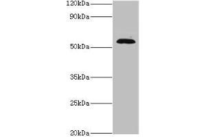Western blot All lanes: TSEN2 antibody at 5 μg/mL + 293T whole cell lysate Secondary Goat polyclonal to rabbit IgG at 1/10000 dilution Predicted band size: 54, 52, 50, 48, 46 kDa Observed band size: 54 kDa