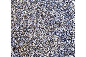 IHC analysis of Ki67/MKI67 using anti-Ki67/MKI67 antibody (ABIN7601873).