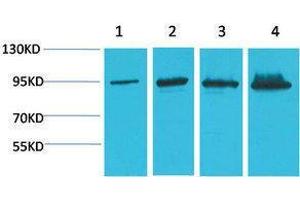 Western Blotting (WB) image for anti-Catenin, beta (CATNB) antibody (ABIN3181549) (beta Catenin antibody)