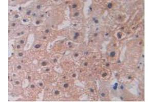 IHC-P analysis of Human Liver Tissue, with DAB staining. (LOXL2 antibody  (AA 544-751))