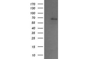 Image no. 1 for anti-SUMO1/sentrin/SMT3 Specific Peptidase 2 (SENP2) antibody (ABIN1500865) (SENP2 antibody)