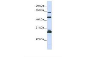 Image no. 1 for anti-Pescadillo Ribosomal Biogenesis Factor 1 (PES1) (C-Term) antibody (ABIN6739037)