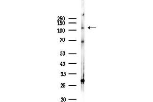 anti-Nicotinamide Nucleotide Transhydrogenase (NNT) (C-Term) antibody
