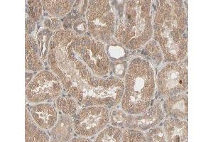 ABIN6266596 at 1/100 staining human kidney tissue sections by IHC-P. (MMP3 antibody  (C-Term))