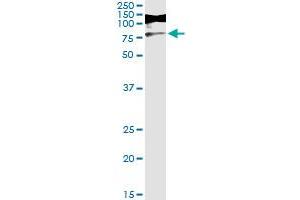 Immunoprecipitation of RIOK3 transfected lysate using anti-RIOK3 monoclonal antibody and Protein A Magnetic Bead , and immunoblotted with RIOK3 MaxPab rabbit polyclonal antibody. (RIOK3 antibody  (AA 1-516))