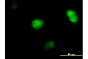 Immunofluorescence of purified MaxPab antibody to POLH on HeLa cell.