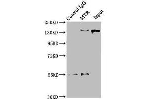 Immunoprecipitating MTR in Hela whole cell lysate Lane 1: Rabbit control IgG instead of ABIN7159585 in Hela whole cell lysate.