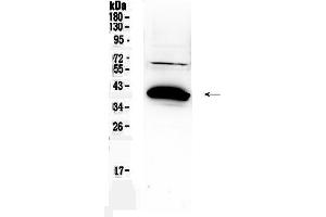 Western blot analysis of Bag1 using anti-Bag1 antibody . (BAG1 antibody  (C-Term))