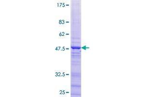 Zinc Finger Protein 385C (ZNF385C) (AA 1-174) protein (GST tag)