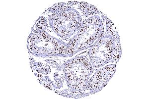Strong nuclear TRIM28 staining in most cells but spermatids are TRIM28 negative