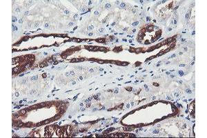 Image no. 1 for anti-phosphofructokinase, Platelet (PFKP) antibody (ABIN1500164) (PFKP antibody)