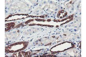 Image no. 1 for anti-phosphofructokinase, Platelet (PFKP) antibody (ABIN1500164) (PFKP antibody)