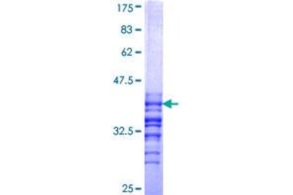 Meningioma 1 Protein (AA 1212-1320) (GST tag)