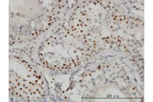 Immunoperoxidase of monoclonal antibody to CTBP1 on formalin-fixed paraffin-embedded human testis. (CTBP1 antibody  (AA 1-429))