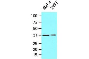 Western Blotting (WB) image for anti-Epilepsy, Progressive Myoclonus Type 2A, Lafora Disease (Laforin) (EPM2A) (AA 243-331) antibody (ABIN336090) (EPM2A antibody  (AA 243-331))