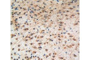 Immunohistochemistry (IHC) image for anti-Insulin-Like Growth Factor 2 Receptor (IGF2R) (AA 1148-1365) antibody (ABIN1859300)
