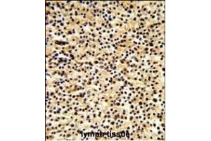 Formalin-fixed and paraffin-embedded human lymph tissue reacted with DTX1 Antibody (Center), which was peroxidase-conjugated to the secondary antibody, followed by DAB staining. (Deltex Homolog 1 antibody  (AA 382-410))