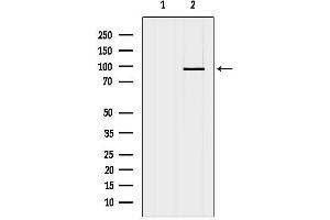 anti-DNA (Cytosine-5-)-Methyltransferase 3 beta (DNMT3B) (N-Term) antibody