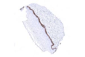 Ectocervix In non keratinizing squamous epithelium the basal cells are CK19 positive while the remaining layers are usually negative (Cytokeratin 19 antibody)