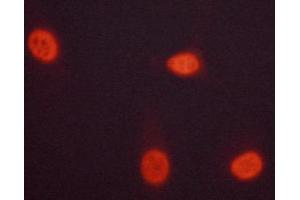 ABIN6267223 staining HeLa cells by ICC/IF. (CHEK1 antibody  (pSer301))