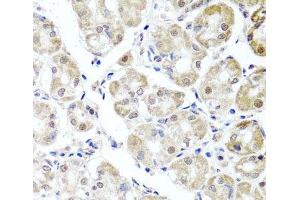 Immunohistochemistry of paraffin-embedded Human stomach using ALKBH4 Polyclonal Antibody at dilution of 1:100 (40x lens). (ALKBH4 antibody)