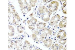 Immunohistochemistry of paraffin-embedded Human stomach using ALKBH4 Polyclonal Antibody at dilution of 1:100 (40x lens).