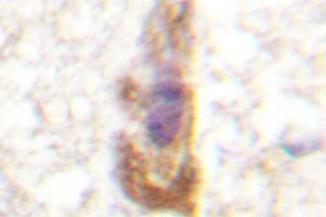 Image no. 1 for anti-Protein Kinase C, zeta (PRKCZ) antibody (ABIN272064) (PKC zeta antibody)