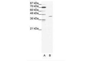 Image no. 1 for anti-T-Cell Acute Lymphocytic Leukemia 1 (TAL1) (C-Term) antibody (ABIN202265)