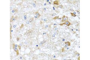 Immunohistochemistry of paraffin-embedded Rat brain using ABCB8 Polyclonal Antibody at dilution of 1:100 (40x lens). (ABCB8 antibody)