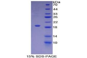 SDS-PAGE (SDS) image for Activin A Receptor, Type IIA (ACVR2A) (AA 20-95) protein (His tag) (ABIN1169769)