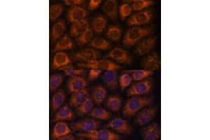 Immunofluorescence analysis of HeLa cells using CCT6B antibody (ABIN7270709) at dilution of 1:100. (CCT6B antibody  (AA 120-340))