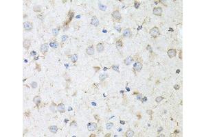 Immunohistochemistry of paraffin-embedded Mouse brain using KLK11 Polyclonal Antibody at dilution of 1:100 (40x lens). (Kallikrein 11 antibody)