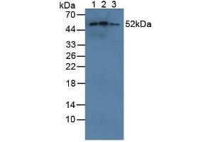 Figure. (CYP21A2 antibody  (AA 37-264))