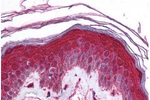 Human Skin (formalin-fixed, paraffin-embedded) stained with KCNN3 antibody ABIN214788 at 5 ug/ml followed by biotinylated goat anti-rabbit IgG secondary antibody ABIN481713, alkaline phosphatase-streptavidin and chromogen. (KCNN3 antibody  (AA 642-691))
