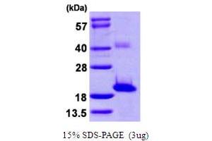 SDS-PAGE (SDS) image for Sentan, Cilia Apical Structure Protein (Sntn) (AA 1-147) protein (His tag) (ABIN667444)