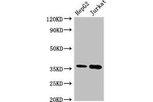 Western Blot Positive WB detected in: HepG2 whole cell lysate, Jurkat whole cell lysate All lanes: TYMS antibody at 2. (TYMS antibody  (AA 2-54))