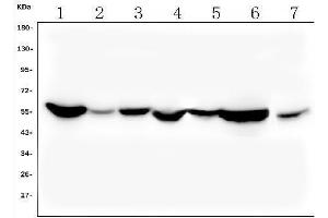 Western blot analysis of ALDH2 using anti-ALDH2 antibody (ABIN7603122).