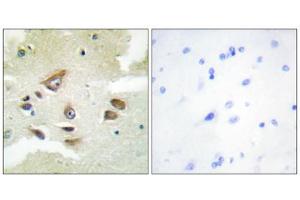 Immunohistochemistry analysis of paraffin-embedded human brain tissue using CLUS antibody. (Clusterin antibody  (C-Term))