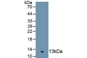 Detection of Recombinant C4c, Human using Polyclonal Antibody to Complement Component 4c (C4c) (Complement C4c antibody  (AA 19-333))