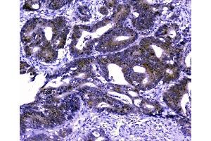 IHC analysis of GOLPH3 using anti-GOLPH3 antibody (ABIN6719570). (GOLPH3 antibody  (AA 56-298))