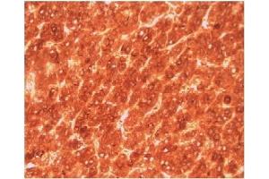 Image no. 1 for anti-alpha-Fetoprotein (AFP) antibody (ABIN950378) (alpha Fetoprotein antibody)