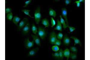 Immunofluorescence staining of A549 cells with ABIN7176088 at 1:266, counter-stained with DAPI. (ZMIZ1 antibody  (AA 405-559))