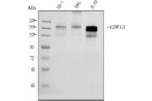 Western blot analysis of CDK13 using anti-CDK13 antibody (ABIN7599667).