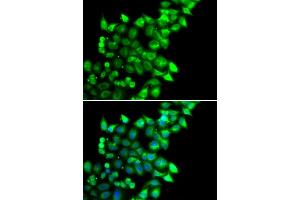 Immunofluorescence analysis of U20S cell using MEST antibody. (MEST antibody)