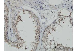 Immunoperoxidase of monoclonal antibody to HSPA1B on formalin-fixed paraffin-embedded human testis. (HSPA1B antibody  (AA 531-611))