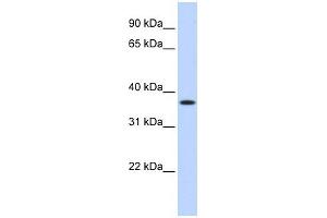 MTHFD2 antibody used at 1 ug/ml to detect target protein. (MTHFD2 antibody)