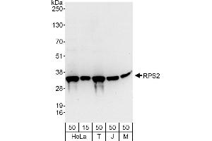 Western Blotting (WB) image for anti-Ribosomal Protein S2 (RPS2) (AA 243-293) antibody (ABIN7450689)