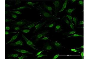 Immunofluorescence of monoclonal antibody to IKZF3 on HeLa cell. (IKZF3 antibody  (AA 1-509))