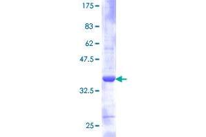 RPS21 Protein (AA 1-81) (GST tag)